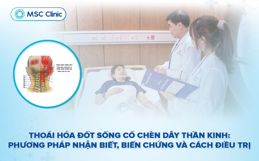 Thoái hóa đốt sống cổ chèn dây thần kinh-01