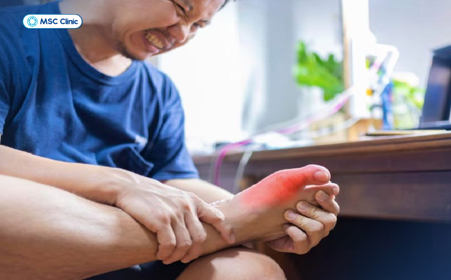 Trật khớp ngón chân thường cảm thấy đau đơn