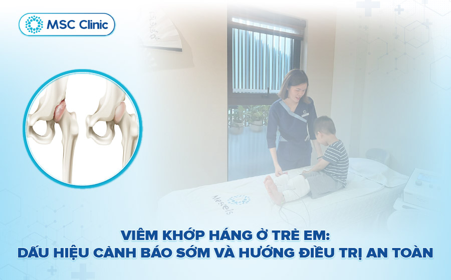 Viêm khớp háng ở trẻ em-01