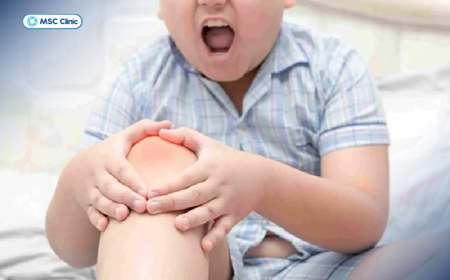 Viêm khớp háng ở trẻ em-04