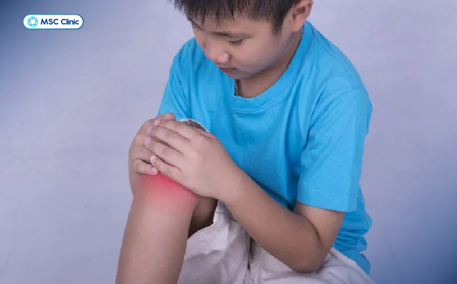 Viêm khớp háng ở trẻ em-05