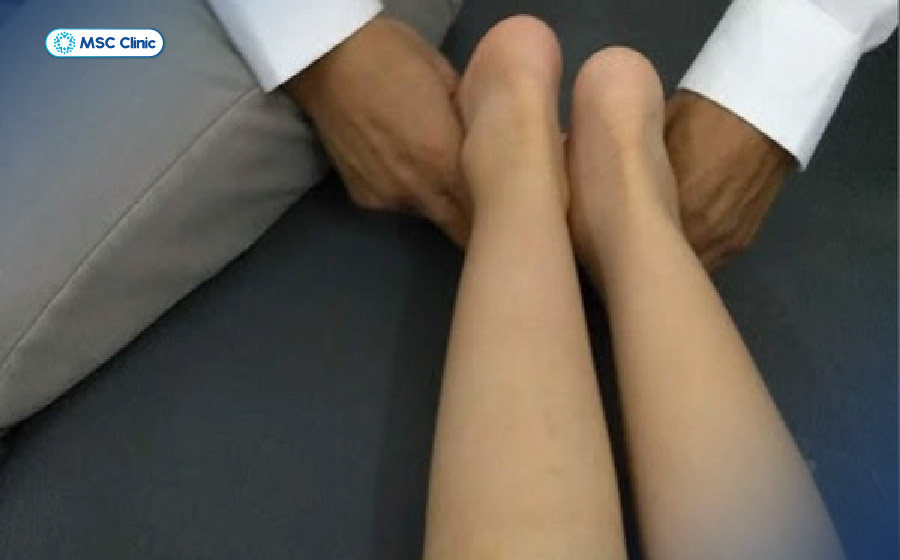 Viêm khớp háng ở trẻ em-06