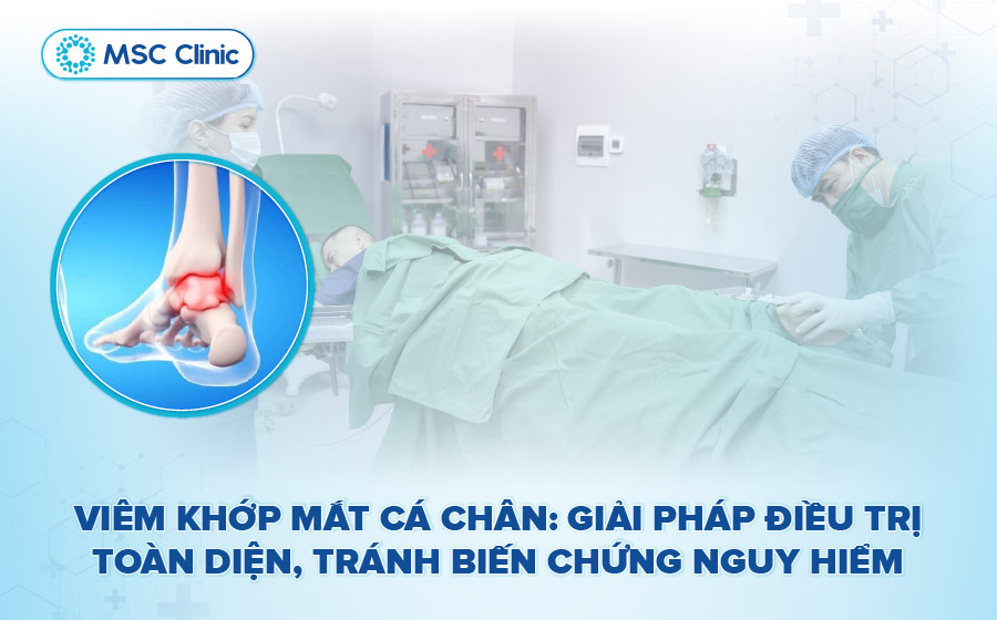 Viêm khớp mắt cá chân-01
