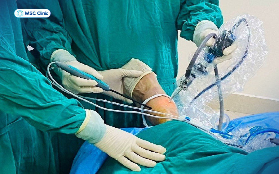 Viêm khớp mắt cá chân-13