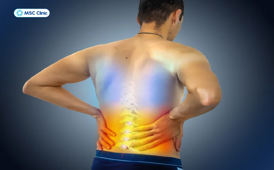 Vùng cơ quanh cột sống co thắt, cứng là dấu hiệu của trật khớp lưng Vùng cơ quanh cột sống co thắt, cứng là dấu hiệu của trật khớp lưng