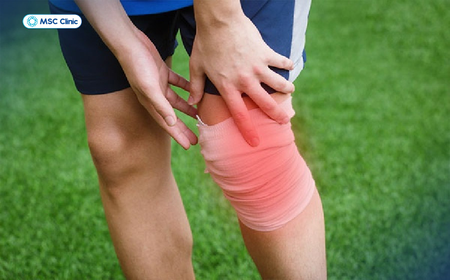 Khi đứt dây chằng chéo bạn có thể nghe thấy tiếng rách, nứt nhỏ đến từ vị trí tổn thương