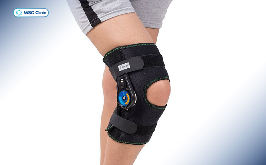 Sử dụng nẹp hỗ trợ để giảm lực, giữ cân bằng sau khi rách dây chằng chéo trước khớp gối