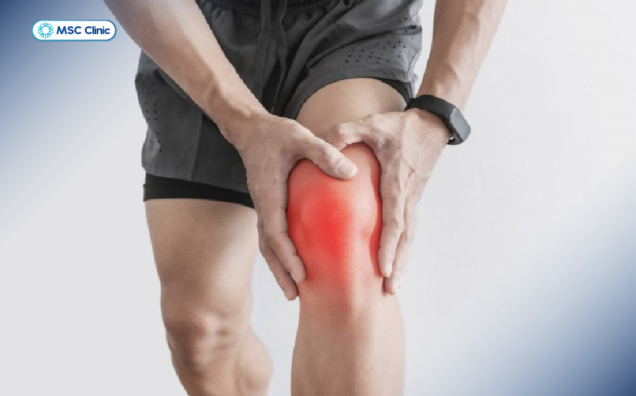 Tiếng “rắc” kèm khớp gối sưng nhanh trong vài giờ cảnh báo chấn thương đứt dây chằng chéo trước