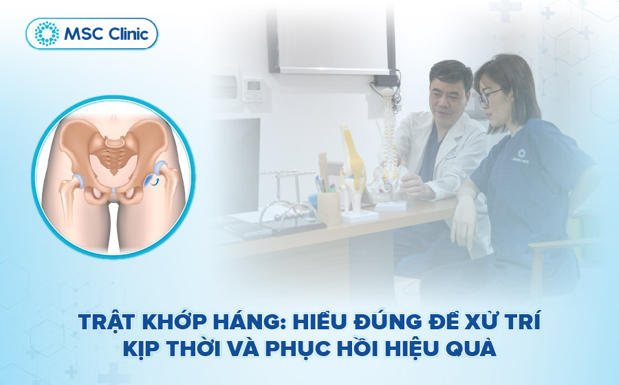 Trật khớp háng: Nguyên nhân và cách xử trí hiệu quả