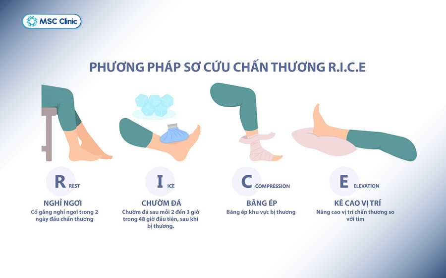 Sơ cứu R.I.C.E là bước xử trí giúp giảm đau, giảm sưng và hạn chế tổn thương nặng hơn
