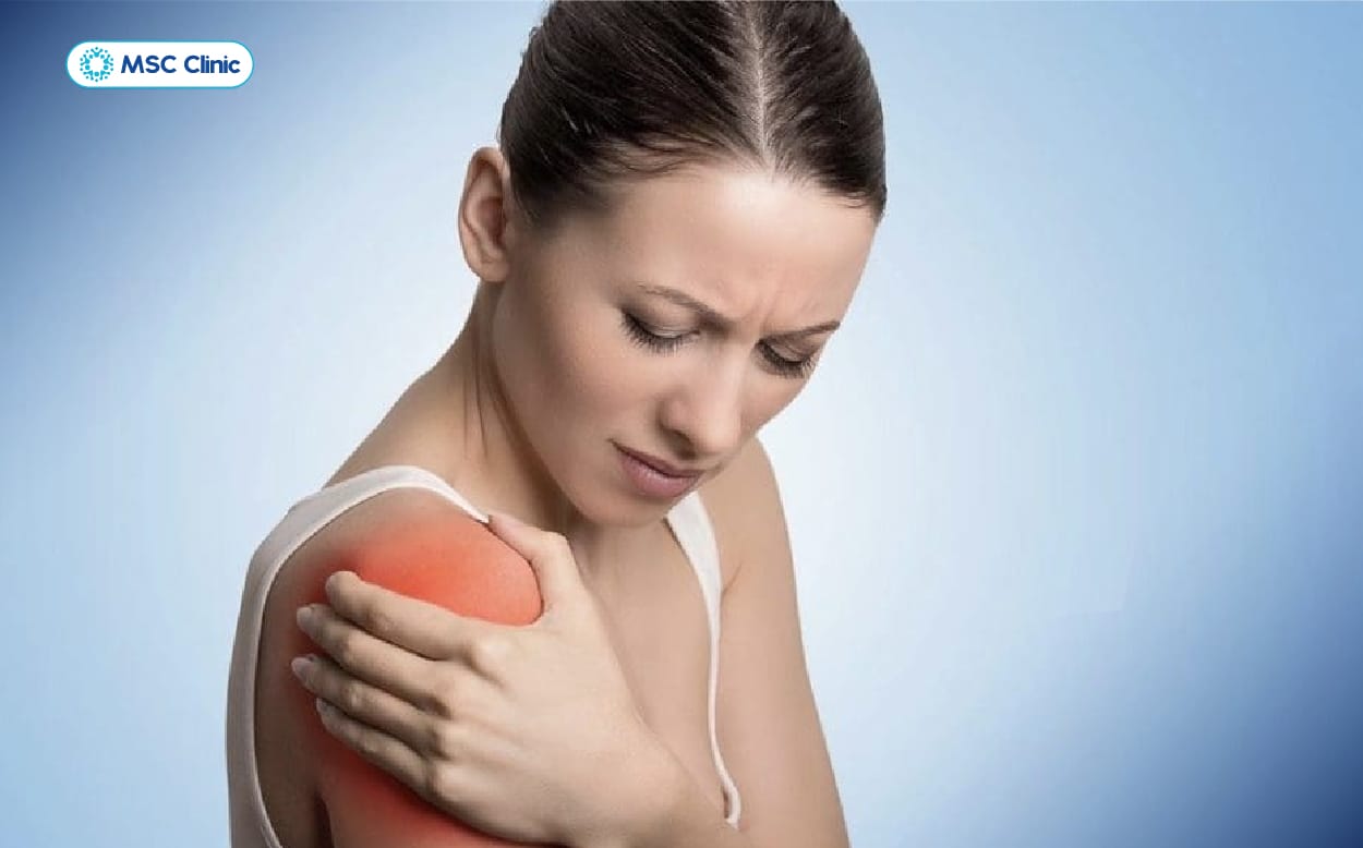 Cơn đau có thể lan dọc khắp cánh tay lên đến vai của người bệnh