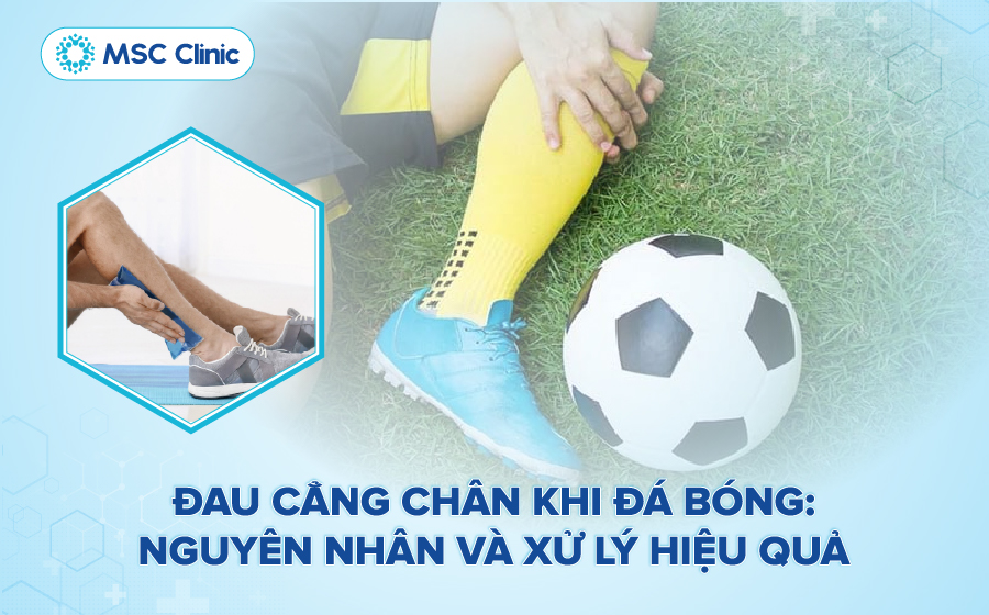Đau cẳng chân khi đá bóng do đâu và hướng dẫn cách xử lý hiệu quả