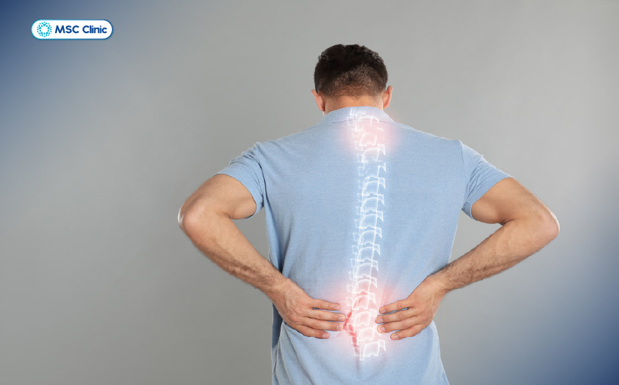 Đau cột sống lưng là tình trạng đau xuất phát từ đĩa đệm, khớp và dây thần kinh