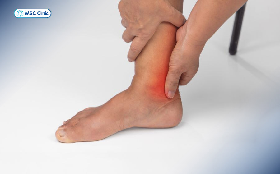 Đau khớp cổ chân là tình trạng vùng khớp nối giữa bàn chân và cẳng chân bị đau hoặc khó cử động