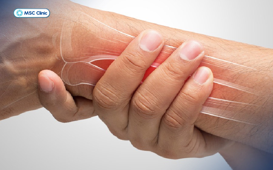Đau khớp cổ tay thường do nhiều nguyên nhân khác nhau gây ra