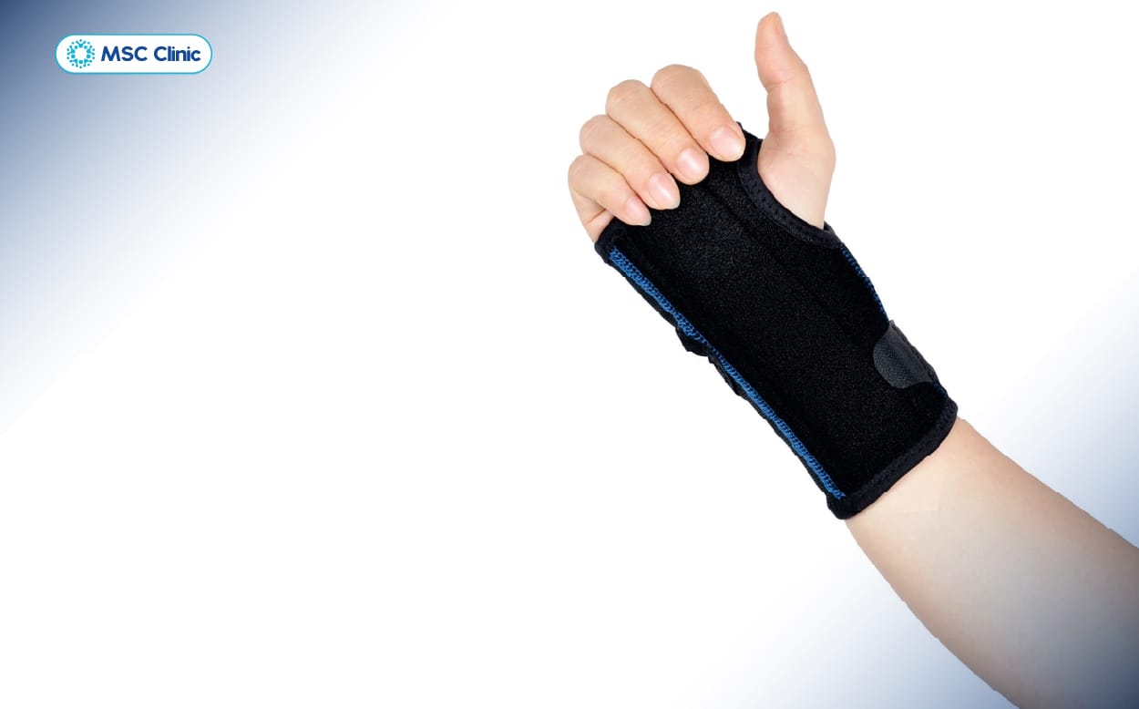 Dùng nẹp giúp giảm áp lực bên trong ống cổ tay và giữ cổ tay ở tư thế thoải mái nhất