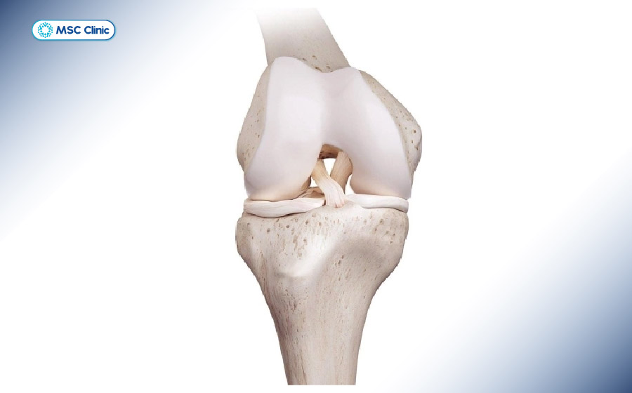 Khả năng tự chữa lành của dây chằng rất thấp nếu không được can thiệp hỗ trợ