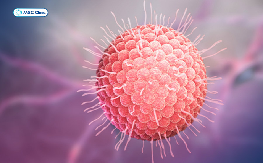 Virus zona thần kinh tái hoạt động và gây đau dây thần kinh liên sườn