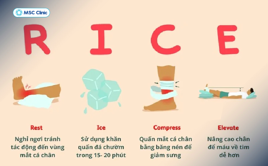 Phương pháp RICE giúp giảm đau cẳng chân khi đá bóng