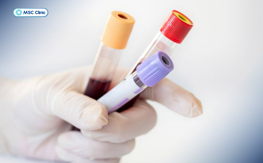 Phương pháp xét nghiệm máu giúp pháp hiện đau khớp cổ chân có đến từ bệnh lý khác hay không