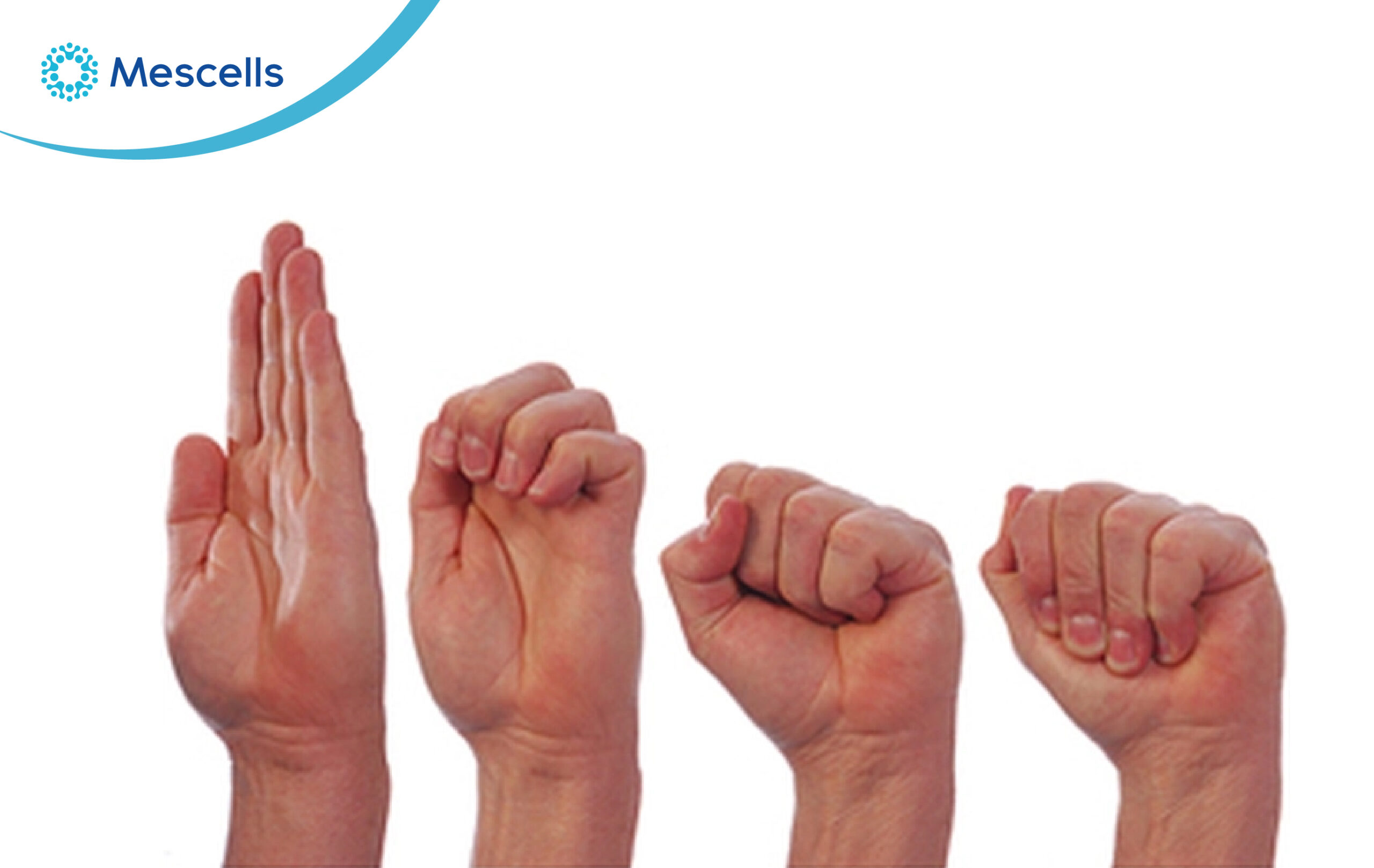 Suy giảm khả năng vận động rất nguy hiểm và mất nhiều thời gian tập luyện để hồi phục Suy giảm khả năng vận động rất nguy hiểm và mất nhiều thời gian tập luyện để hồi phục