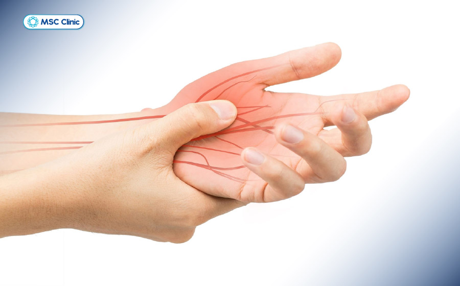 Tê bì chân tay có thể xuất hiện thoáng qua, nhanh chóng biến mất khi thả lỏng