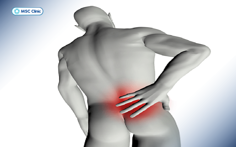 Tê cứng khu vực mông và hậu môn là dấu hiệu đặc biệt cần lưu ý Tê cứng khu vực mông và hậu môn là dấu hiệu đặc biệt cần lưu ý