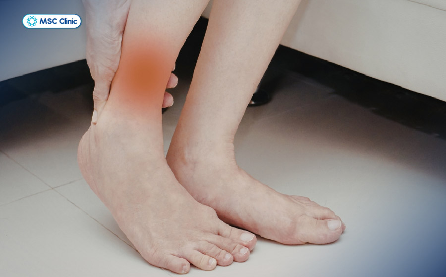 Tình trạng đau khớp cổ chân thường có sưng và hạn chế vận động