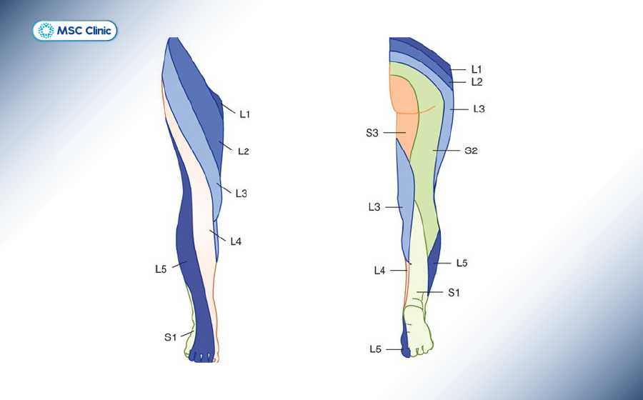Vị trí rễ thần kinh bị chèn ép Vị trí rễ thần kinh bị chèn ép