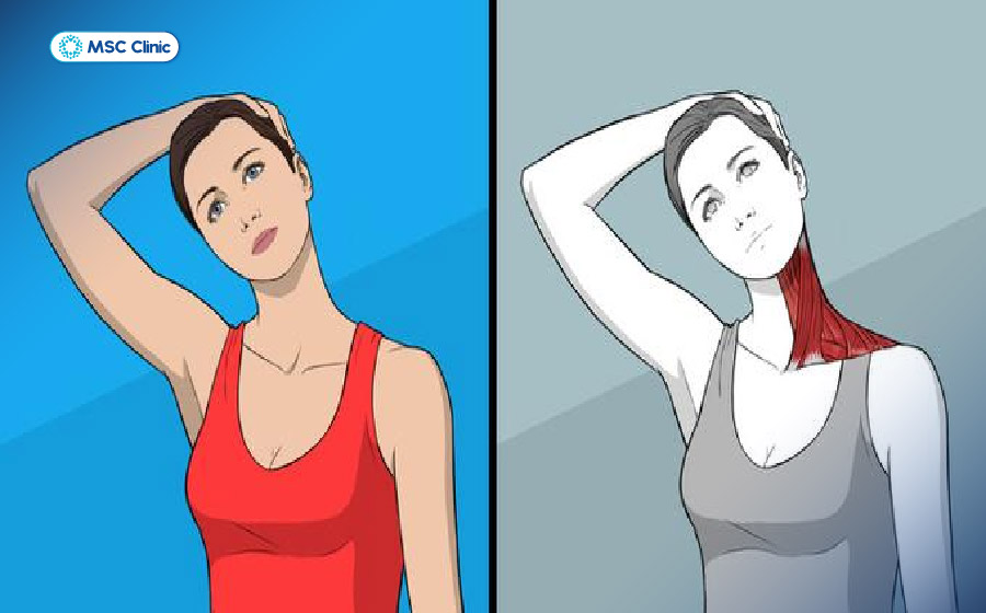 Bài tập kéo giãn cơ vai và cổ sang một bên Bài tập kéo giãn cơ vai và cổ sang một bên