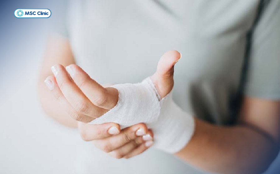 Băng ép và kê cao tay giúp giảm tích tụ dịch khớp ngón tay Băng ép và kê cao tay giúp giảm tích tụ dịch khớp ngón tay