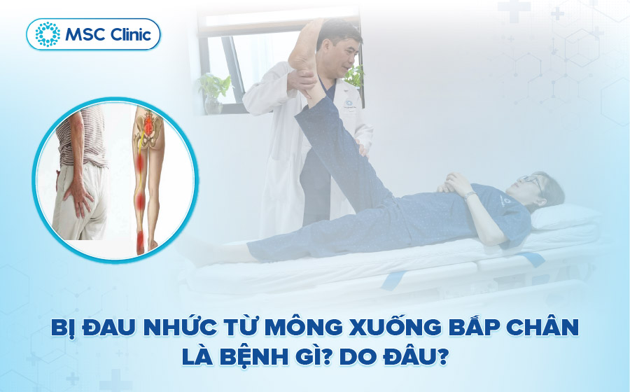 Bị đau nhức từ mông xuống bắp chân là bệnh gì? Do đâu?