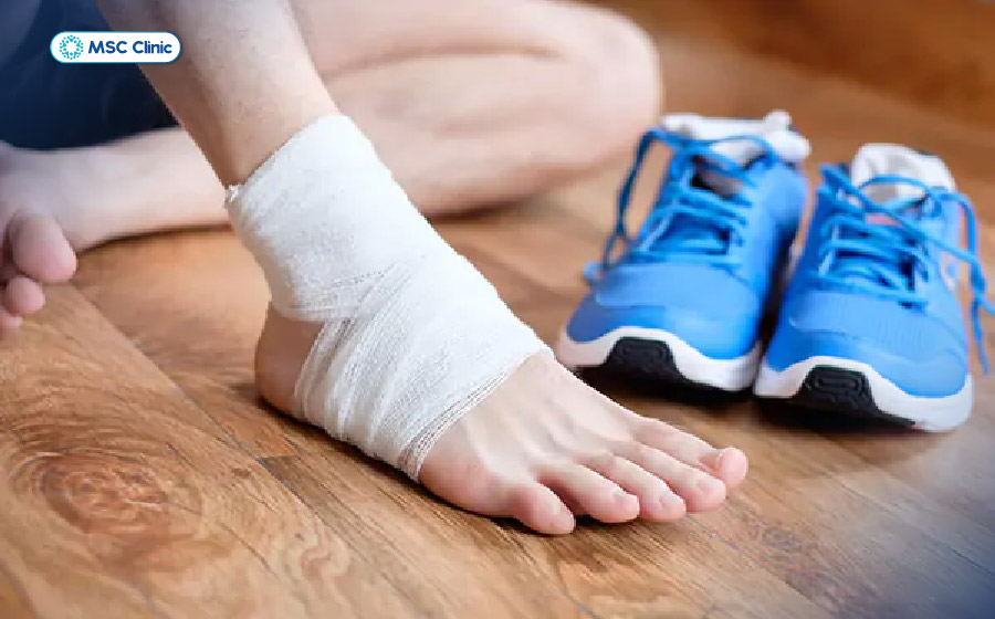 Bong gân, trật khớp là một trong những nguyên nhân gây tràn dịch khớp cổ chân 