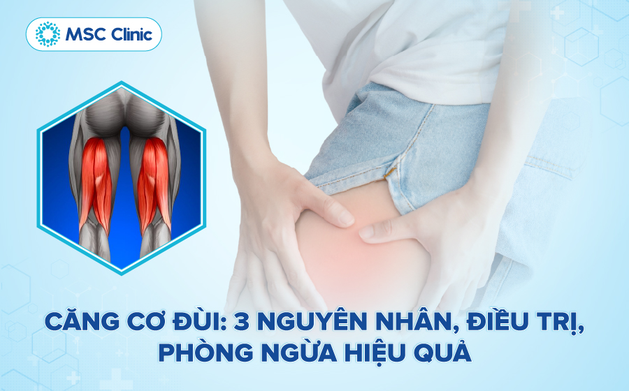 Căng cơ đùi thường xảy ra khi vận động quá mức, gây đau và sưng tấy