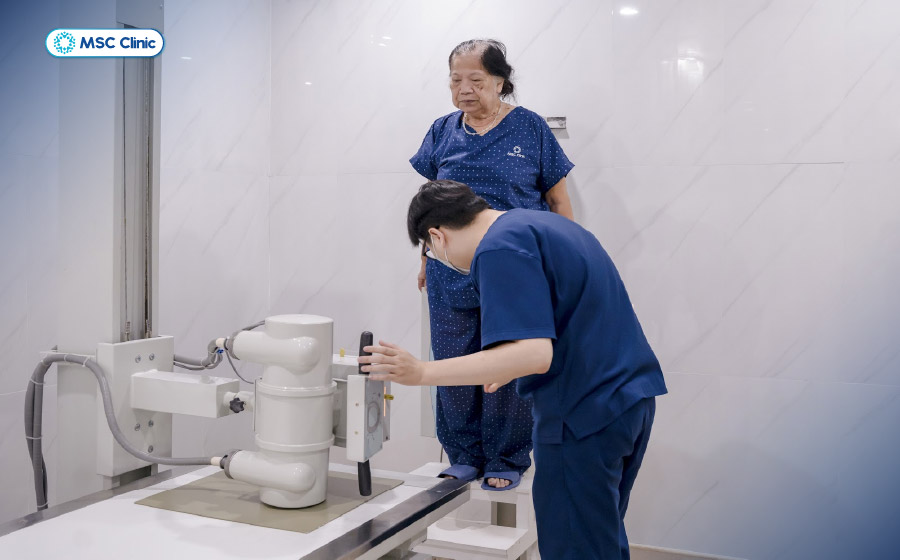 Chụp X-quang thường được chỉ định để đánh giá cấu trúc xương và bề mặt khớp