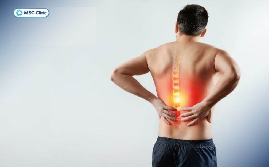 Đau lưng là dấu hiệu rõ rệt nhất của xẹp đốt sống