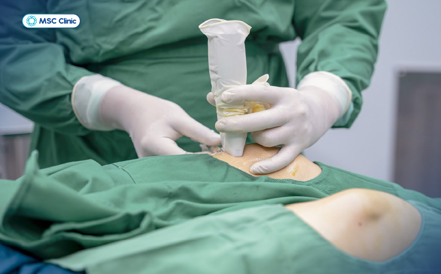 Dựa vào đặc điểm dịch khớp, bác sĩ có thể phân biệt các bệnh lý khác nhau gây tràn dịch khớp