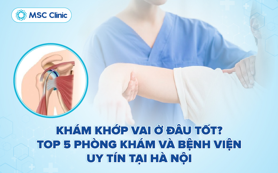 Khám khớp vai ở đâu tốt? Top 5 địa chỉ uy tín tại Hà Nội
