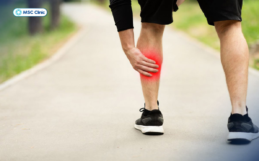 Không khởi động kỹ càng trước khi vận động có thể gây đau bắp chân 
