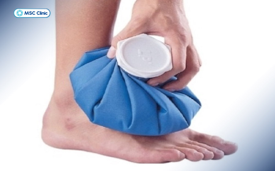Nên sử dụng túi chườm lạnh chuyên dụng hoặc bọc khăn để tránh bị bỏng lạnh