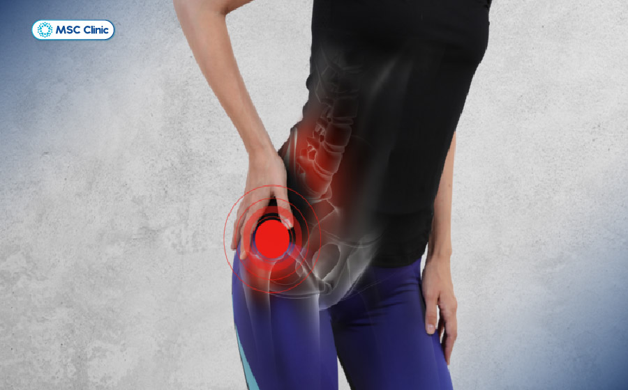 Nếu để kéo dài mà không can thiệp, dịch khớp háng tích tụ gây tổn thương khớp vĩnh viễn Nếu để kéo dài mà không can thiệp, dịch khớp háng tích tụ gây tổn thương khớp vĩnh viễn