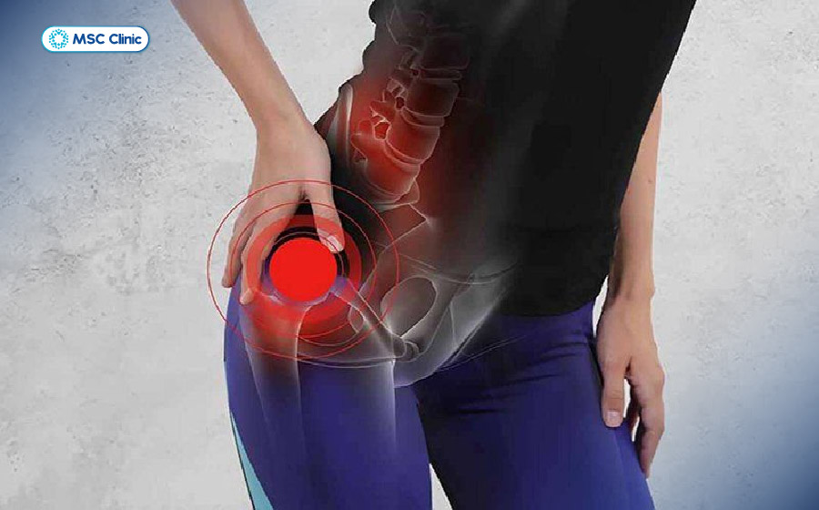 Người bệnh thường khó bắt chéo chân, xoay háng hoặc cúi người