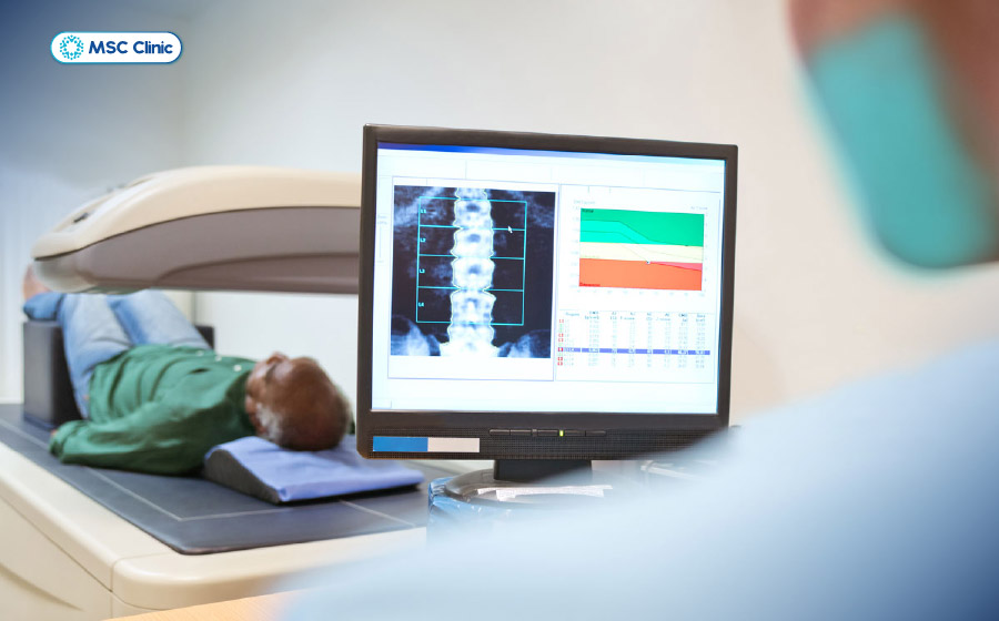 Phương pháp đo mật độ xương (DEXA) để chẩn đoán vấn đề loãng xương