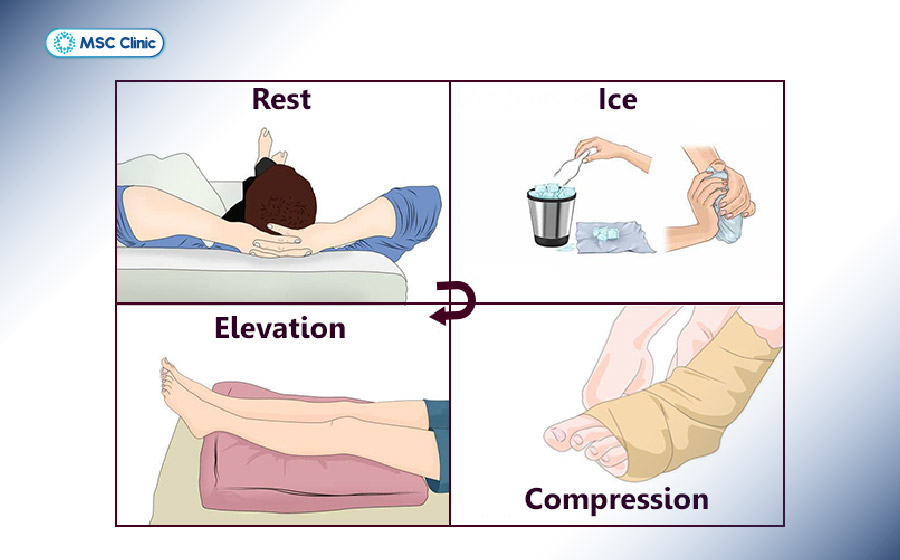Phương pháp R.I.C.E là bước xử trí đầu giúp giảm đau, sưng và hạn chế tổn thương nặng hơn