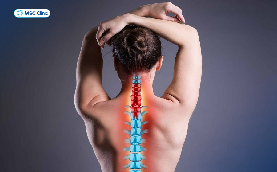 Thoát vị đĩa đệm gây đau dữ dội lan ra vùng cổ vai gáy Thoát vị đĩa đệm gây đau dữ dội lan ra vùng cổ vai gáy
