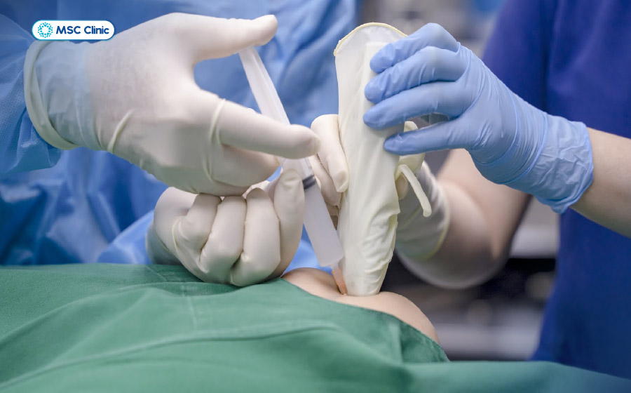 Tiêm PRP dưới hướng dẫn siêu âm giúp đưa chính xác huyết tương giàu tiểu cầu vào vị trí tổn thương