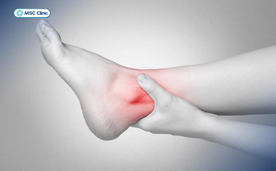 Tràn dịch khớp cổ chân gây sưng đau, khó vận động và ảnh hưởng đến cuộc sống hàng ngày
