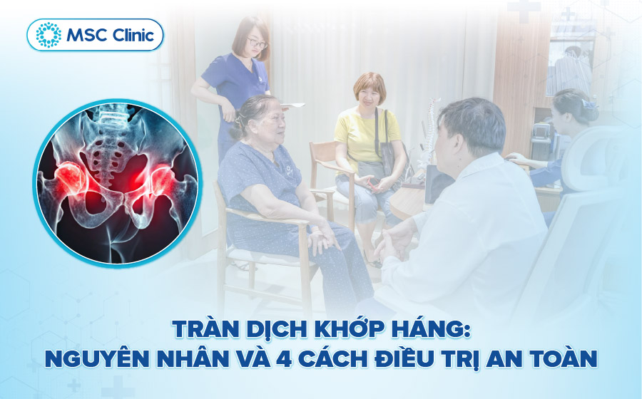 Tràn dịch khớp háng: Nguyên nhân và 4 cách điều trị an toàn
