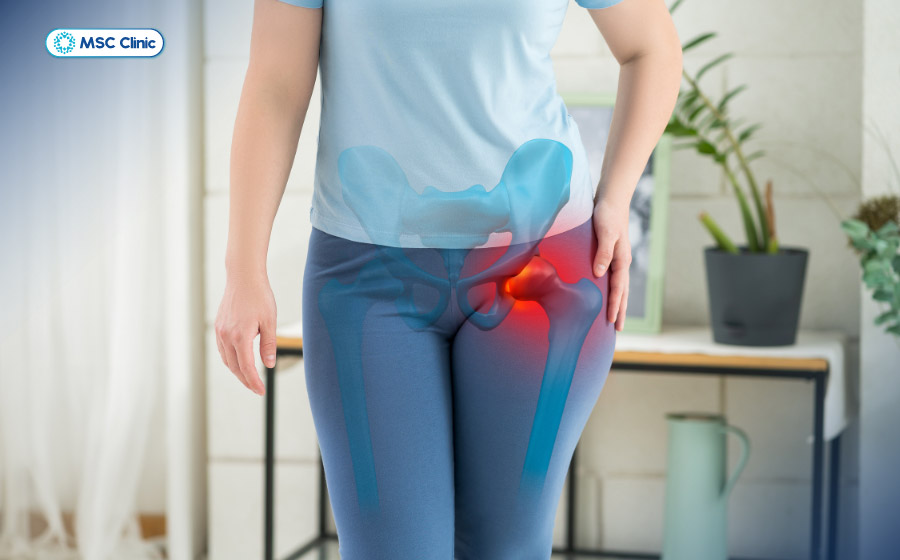 Vận động quá mức dẫn đến tràn dịch khớp háng Vận động quá mức dẫn đến tràn dịch khớp háng