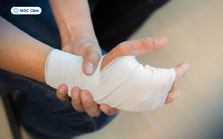 Băng ép quá chặt có thể gây ra những hậu quả nghiêm trọng hơn chính vết thương ban đầu